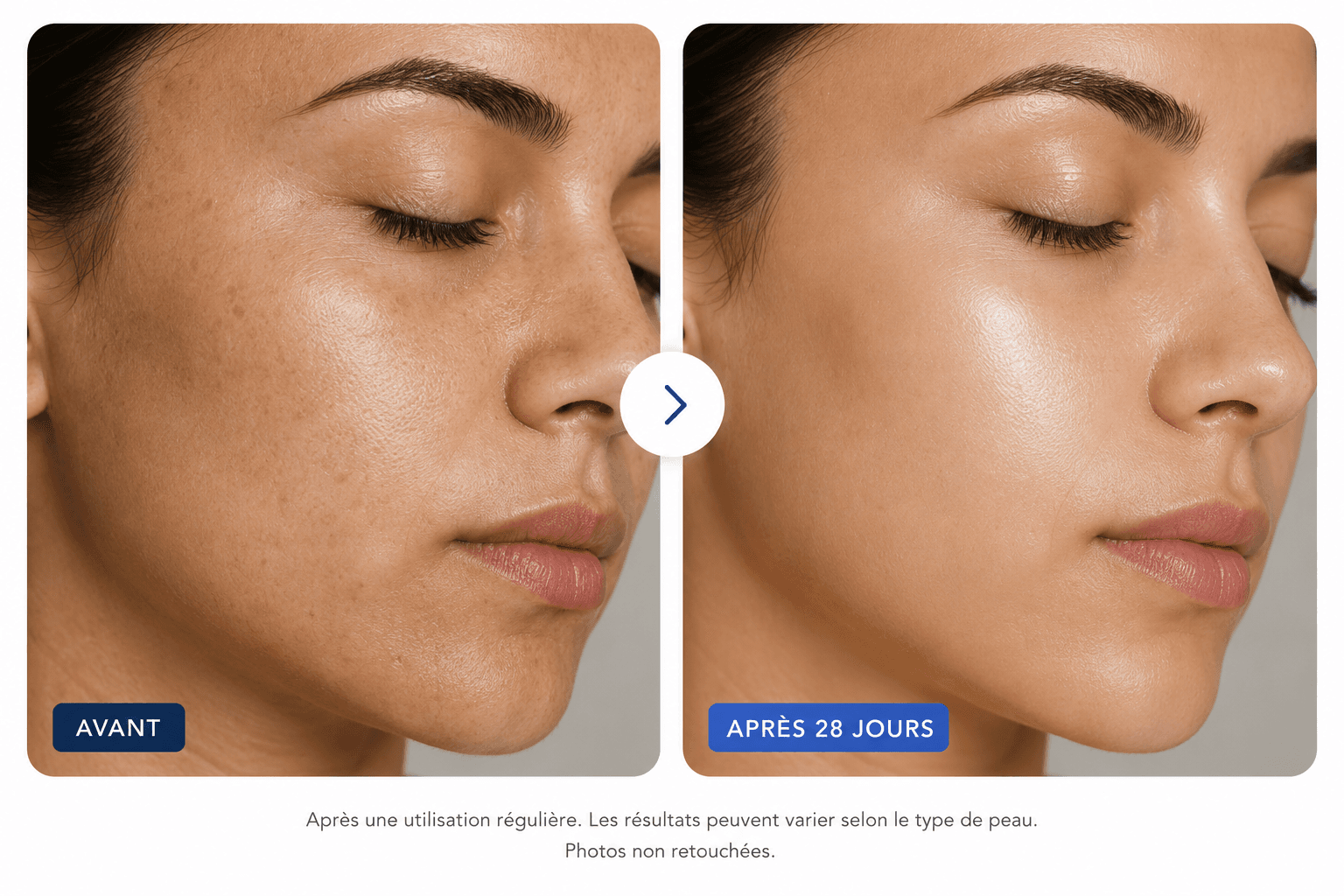 Résultats avant/après 28 jours - Masque Éclaircissant Anissa Cosmetics
